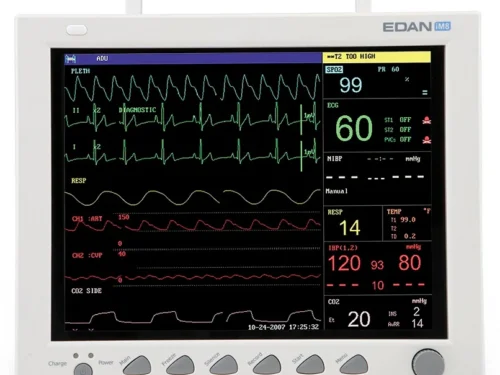 Patient Monitors